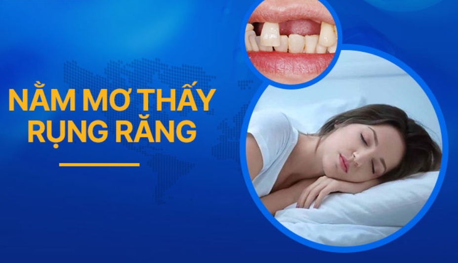 Nằm mơ thấy rụng răng - Giải mã những điềm báo bí ẩn